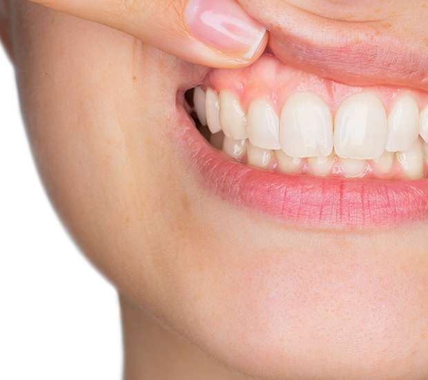 Pleasant Grove Gum Disease